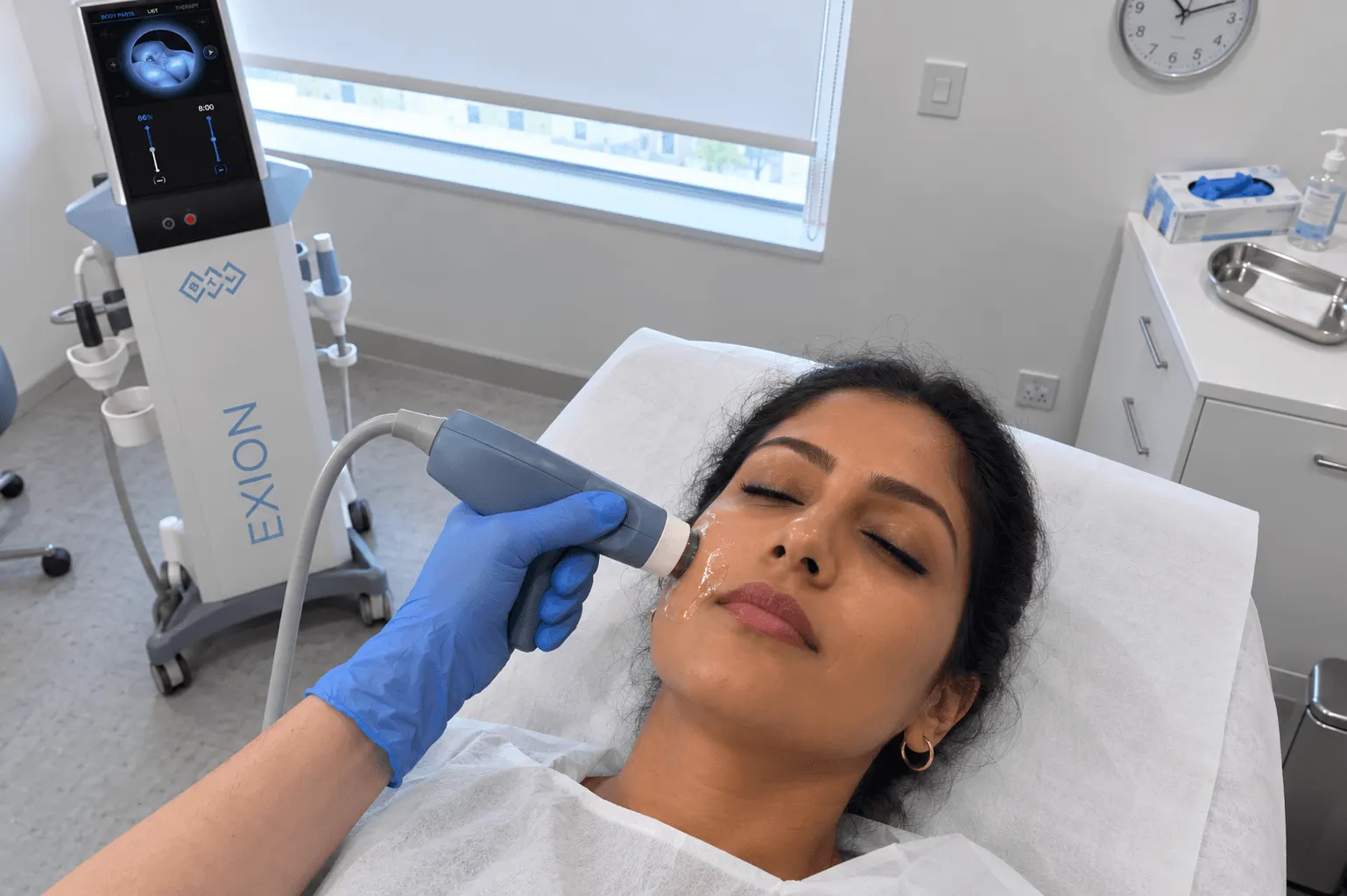 Patient receiving RF microneedling with Exion in Ocala, FL at Chandra Wellness Center