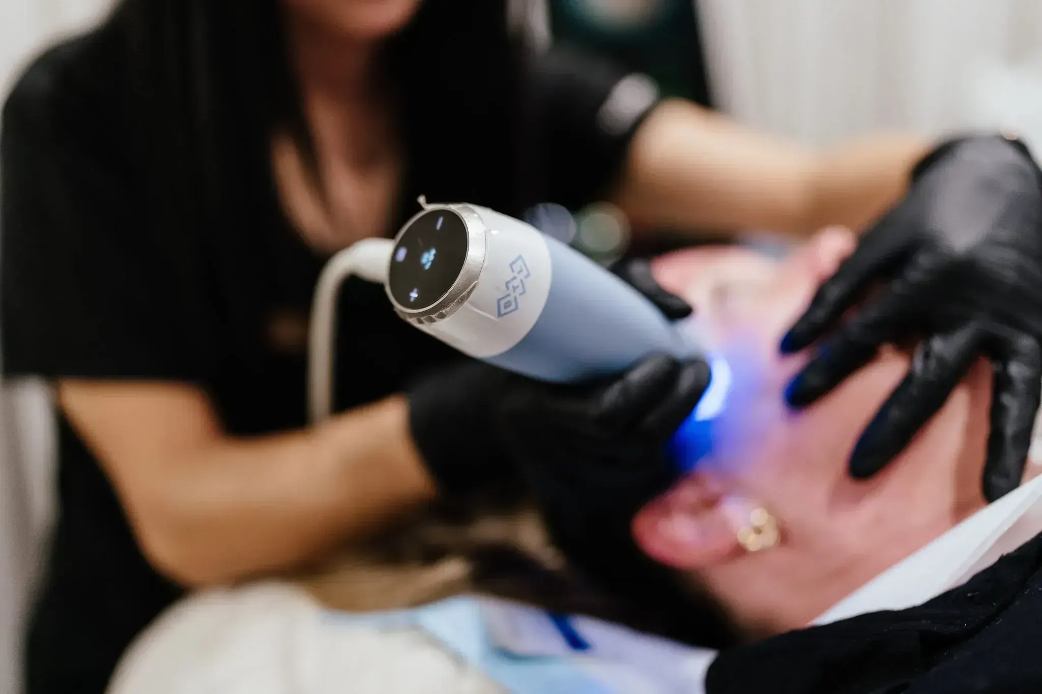 EXION RF microneedling handpiece stimulating collagen at Chandra Wellness in Ocala, Florida
