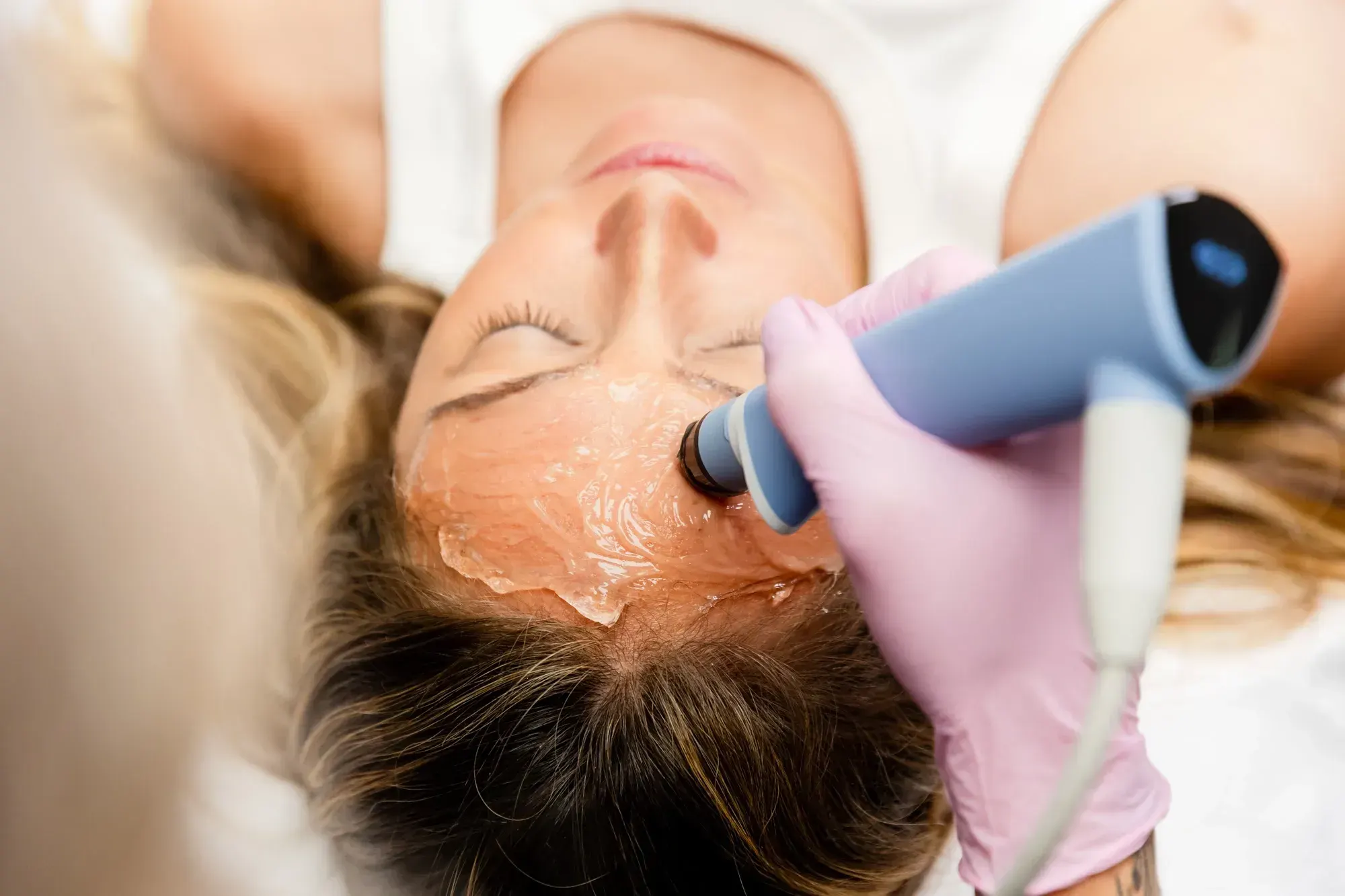 Collagen and elastin stimulating EXION treatment at Chandra Wellness Center in Ocala, FL